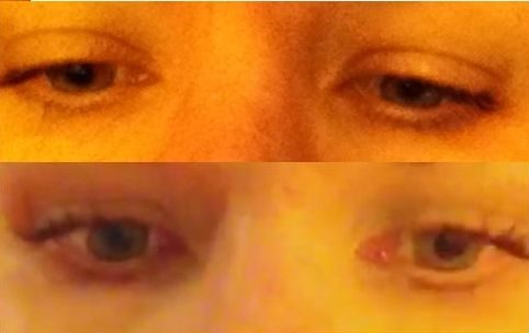 Advanced Eyelash Growth Serum